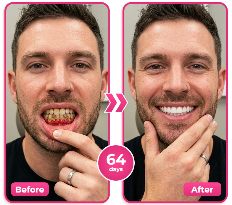 🔥Natravor® Thismile NH-10 Toothpaste Serum for Enamel and Gum Care – Advanced Therapy🥬